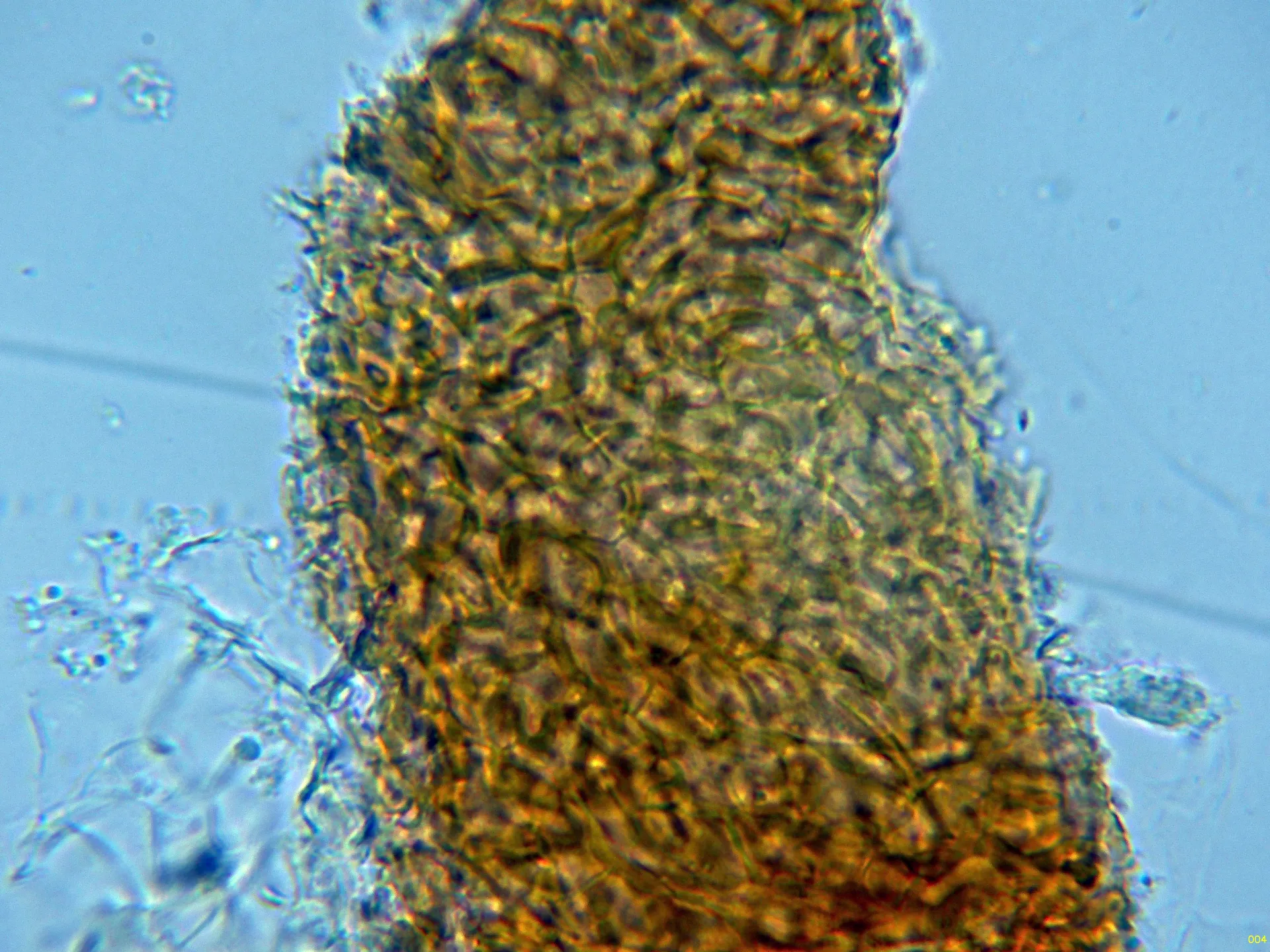 Microscopía de Stylonectria purtonii - 10 - Peridio agua-004